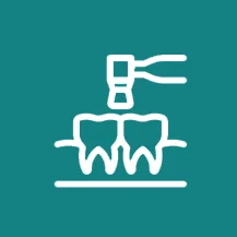 Dental Surgery in Islamabad