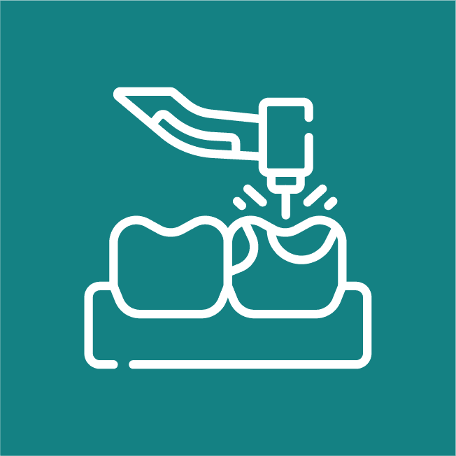 sealants innovative dentistree