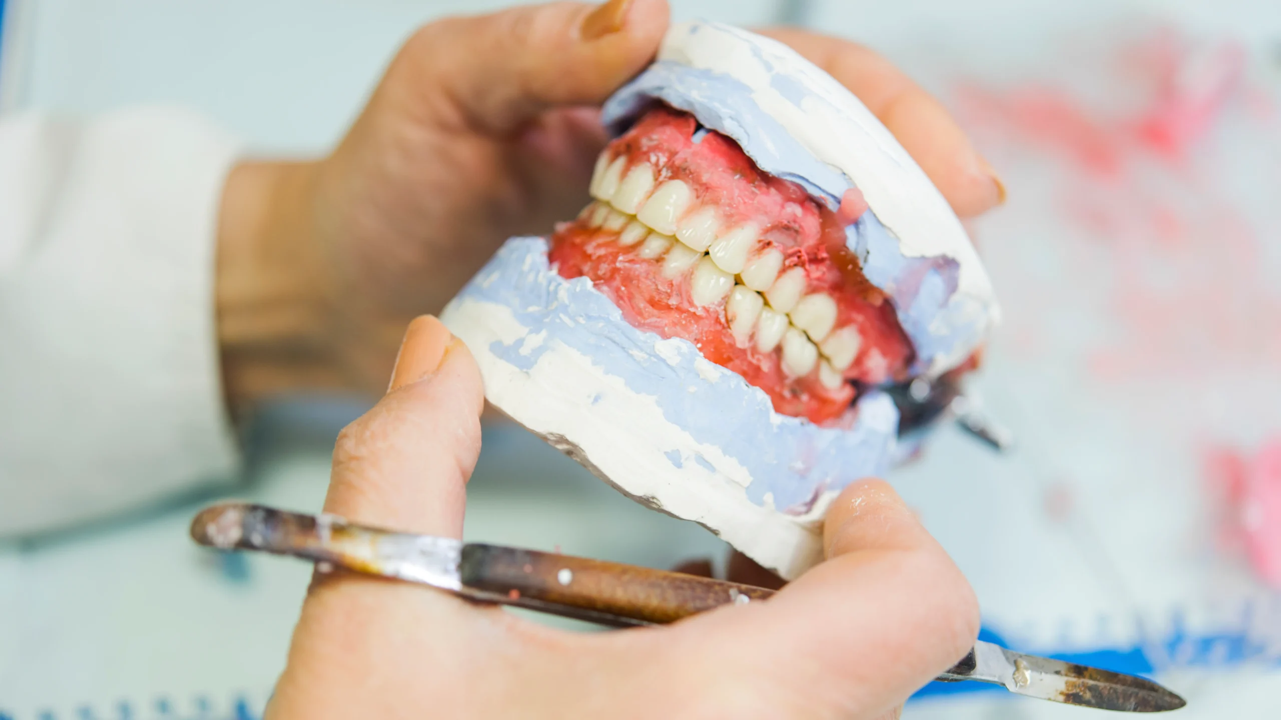 Gum recession