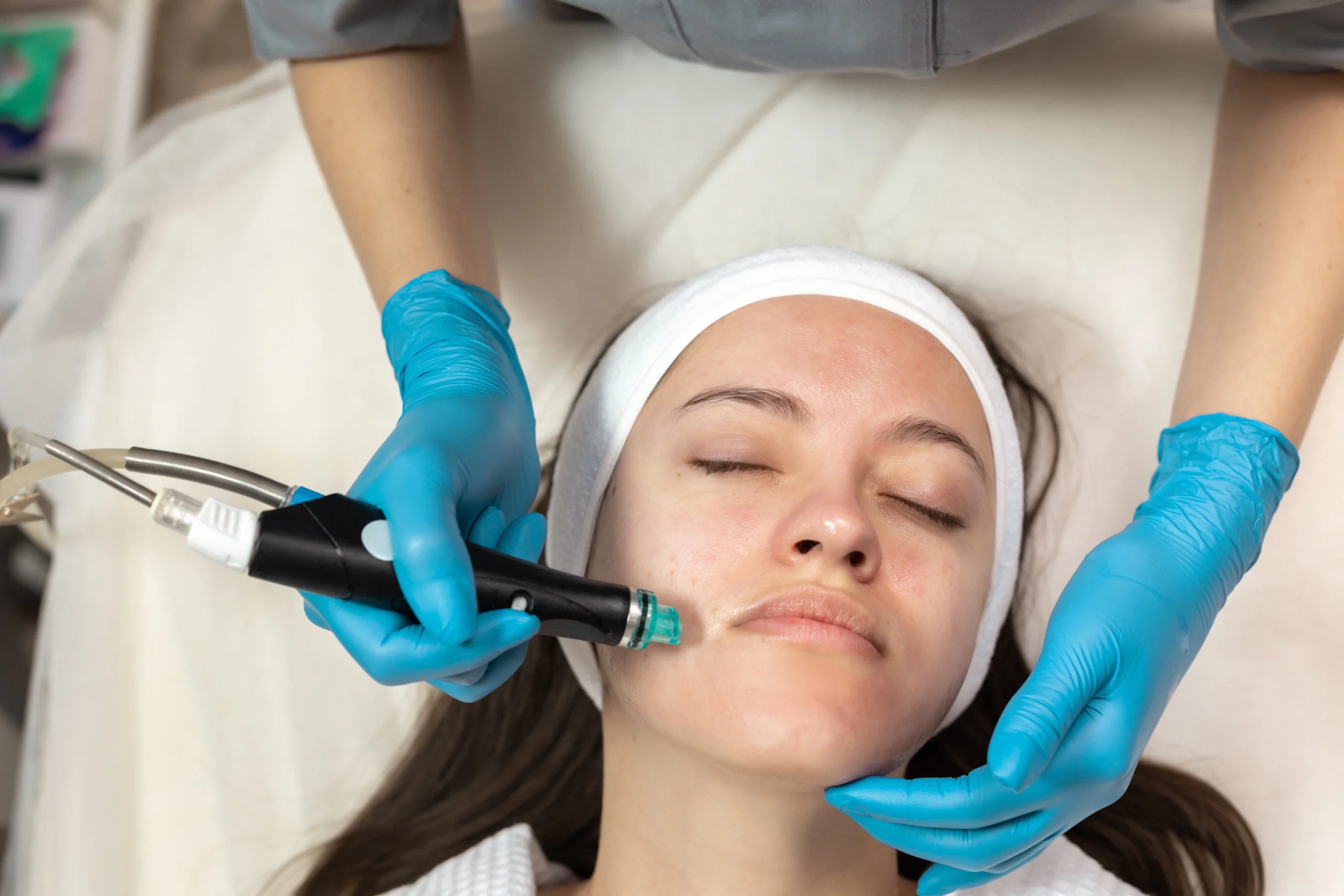 Pico laser therapy