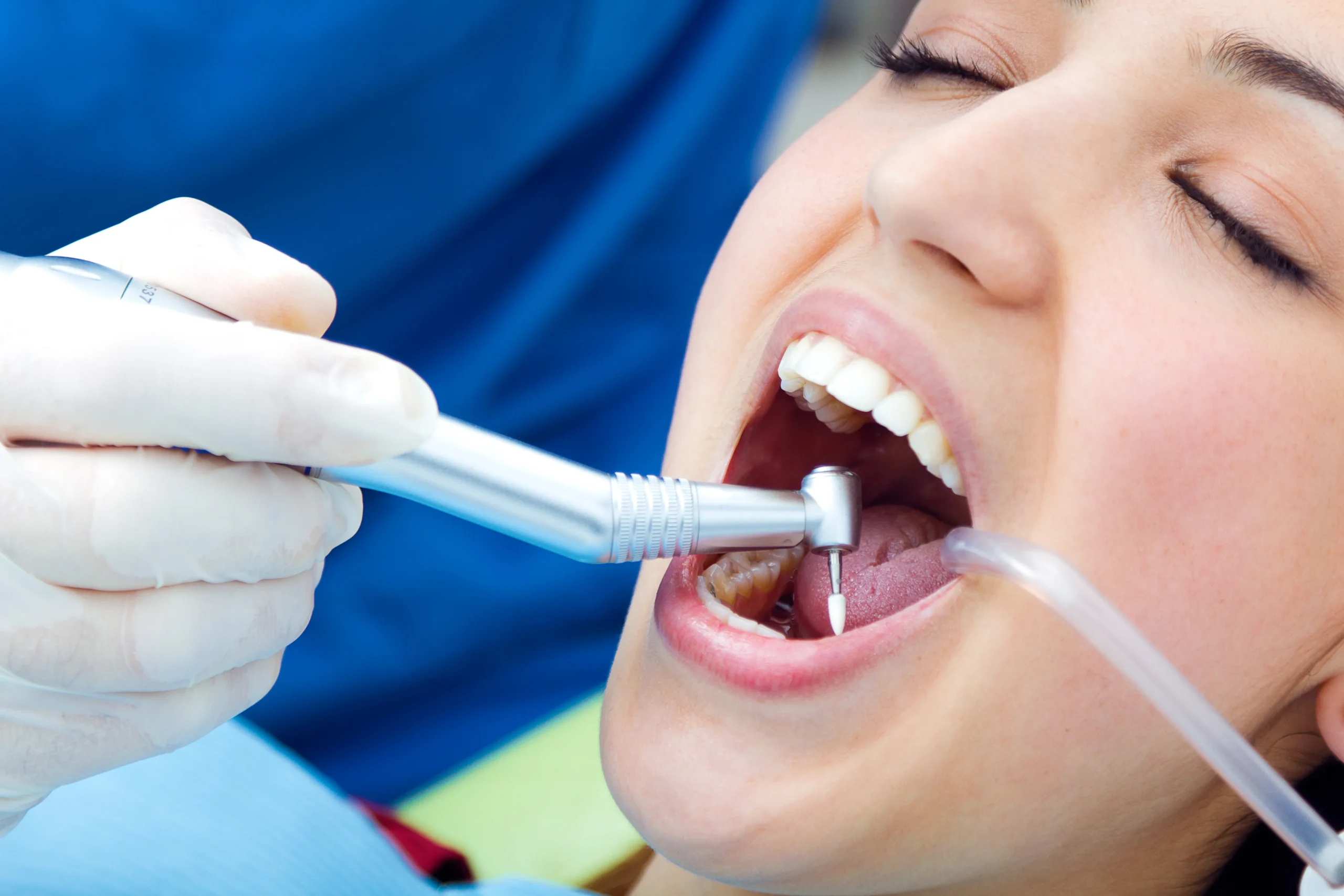Gum disease treatment in Islamabad