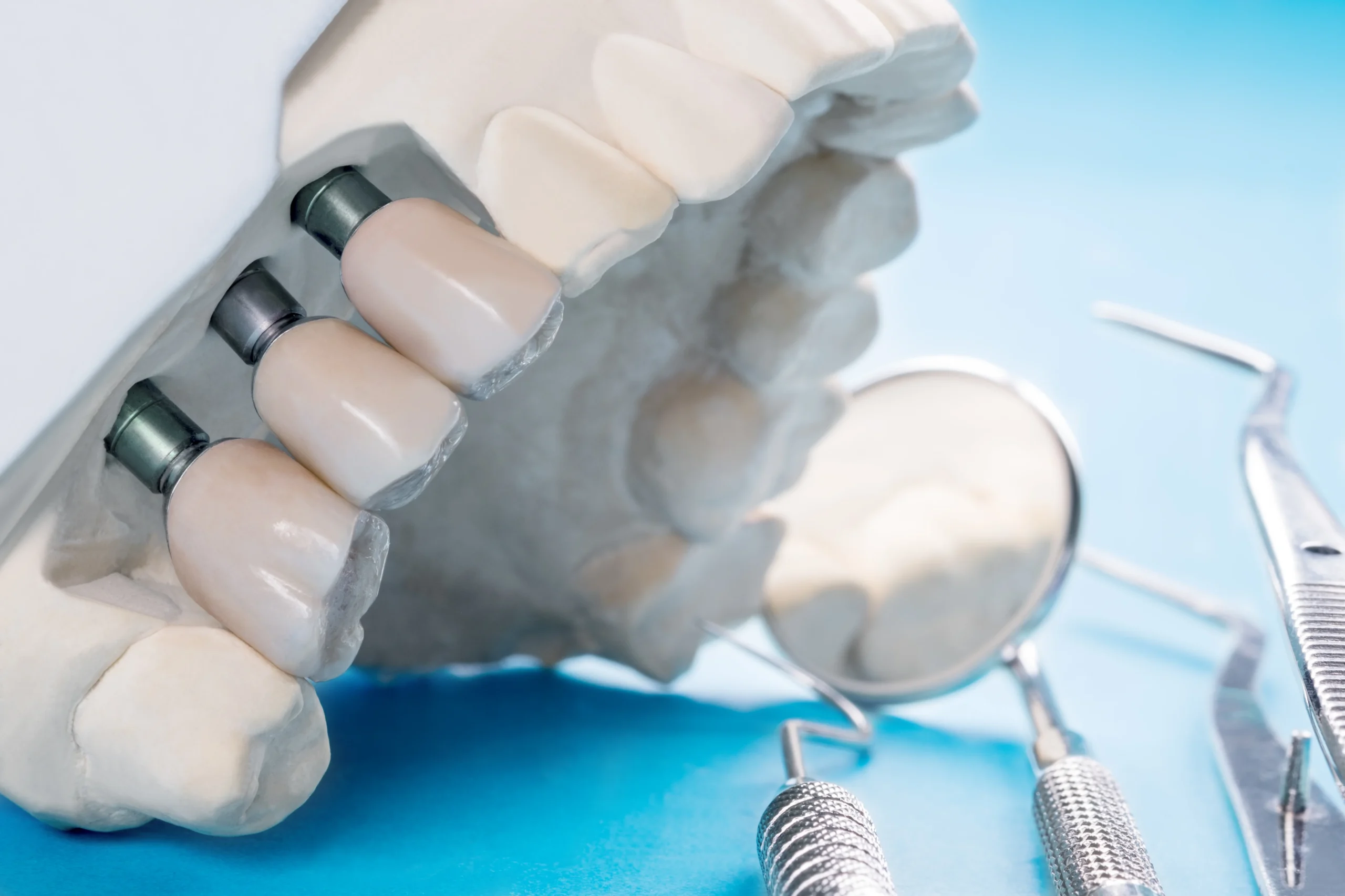 Bruxism