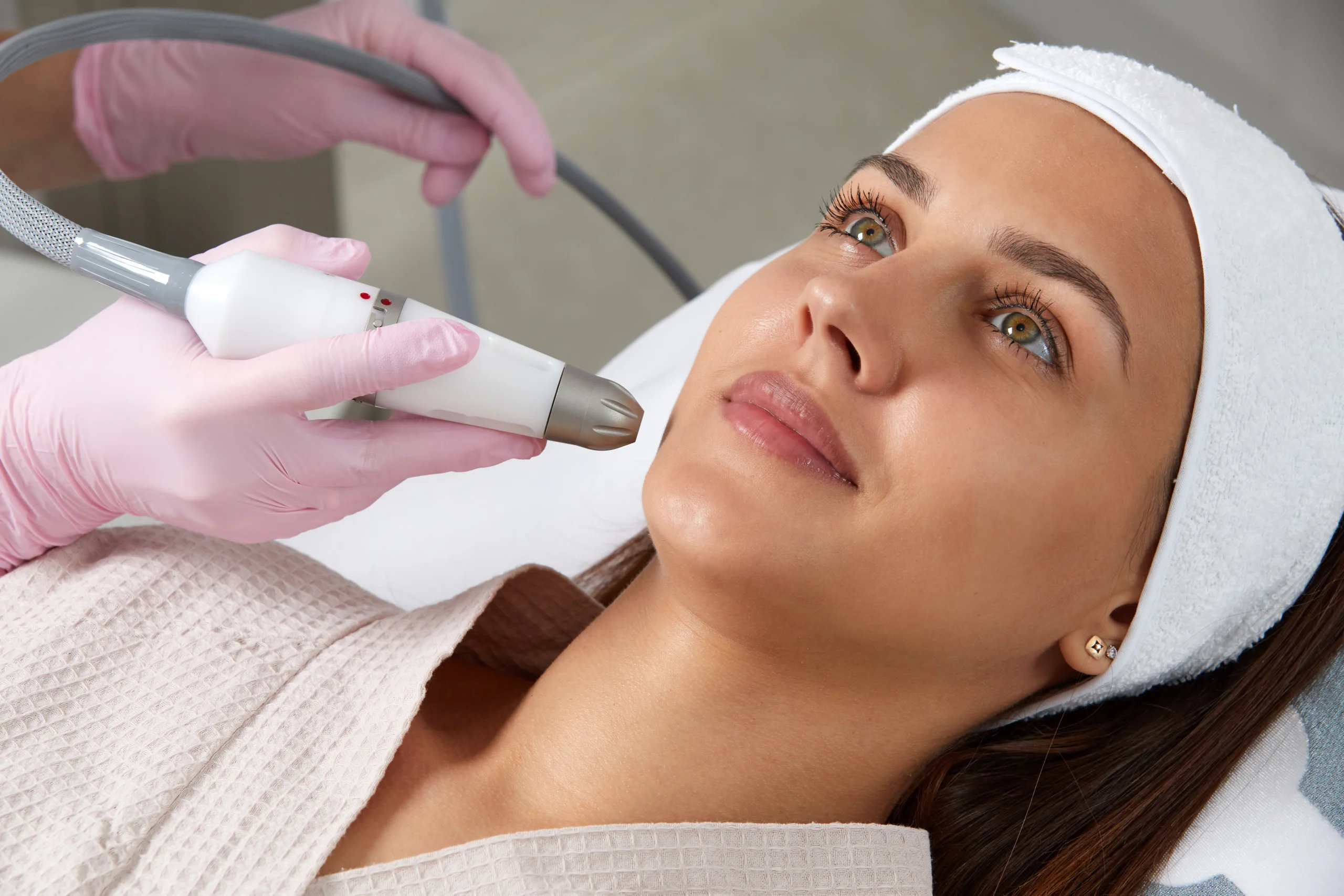 Freckles treatment