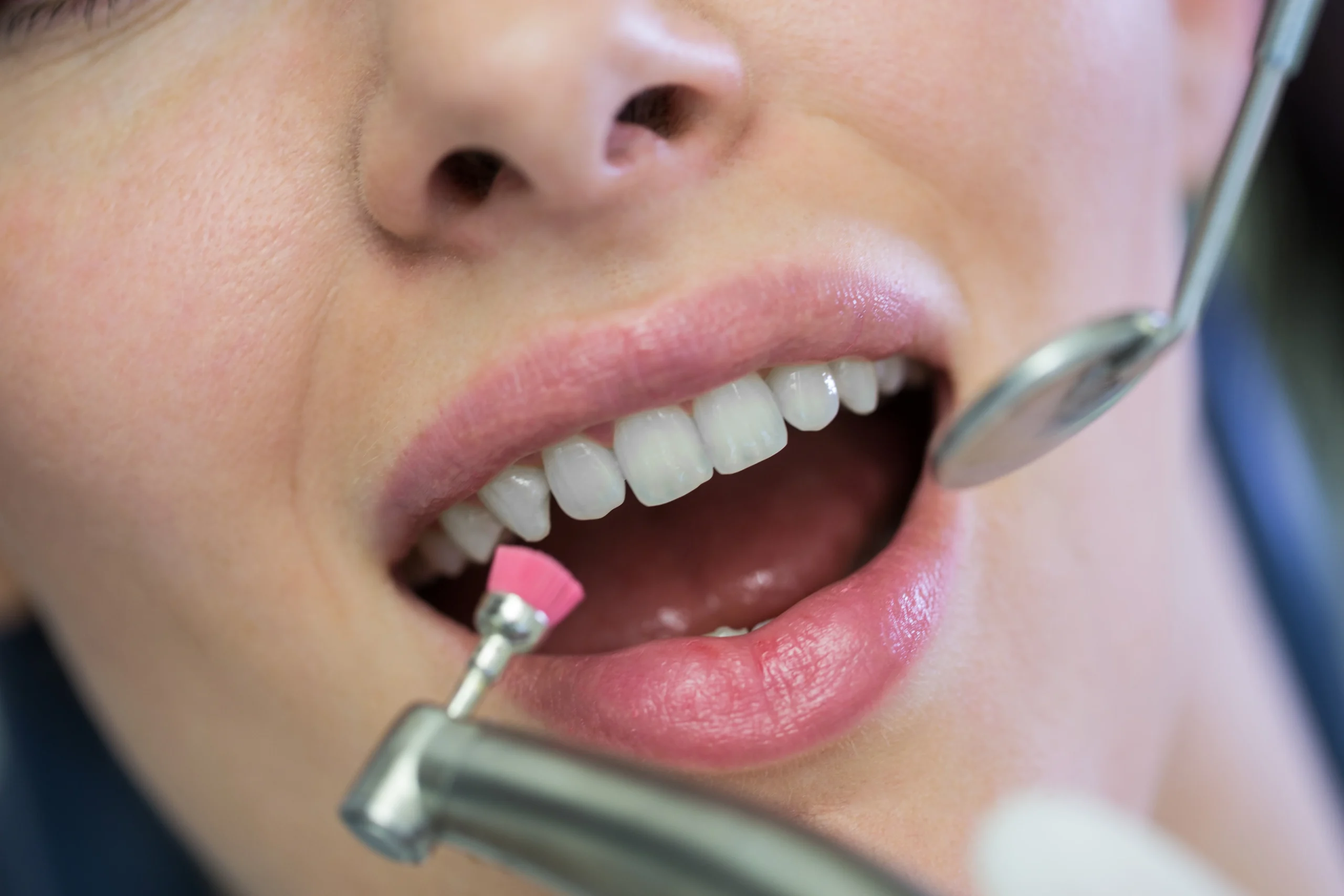 Dentist Performing Pain-Free Dental Filling