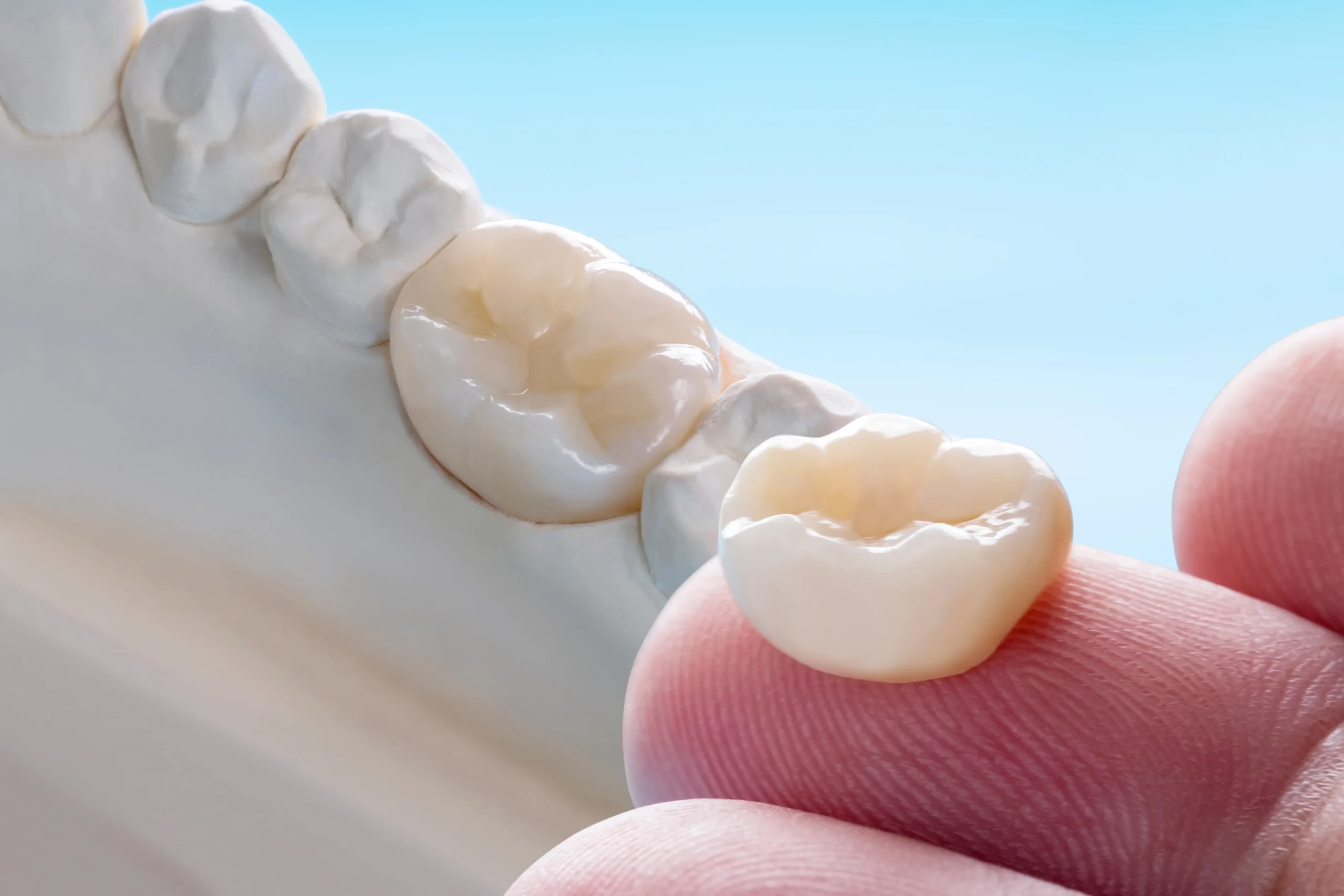 Dental Care