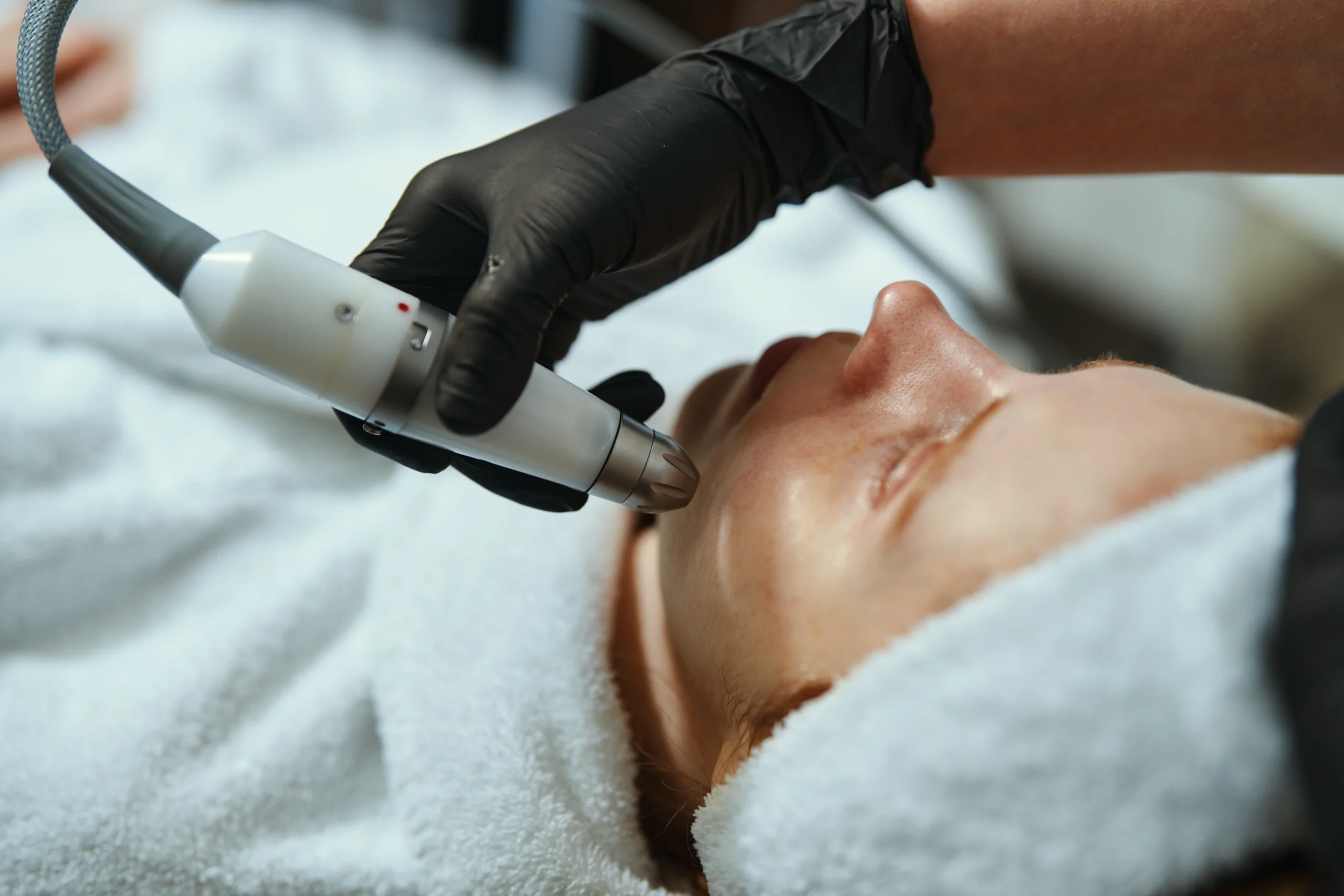 Remove Pigmentation