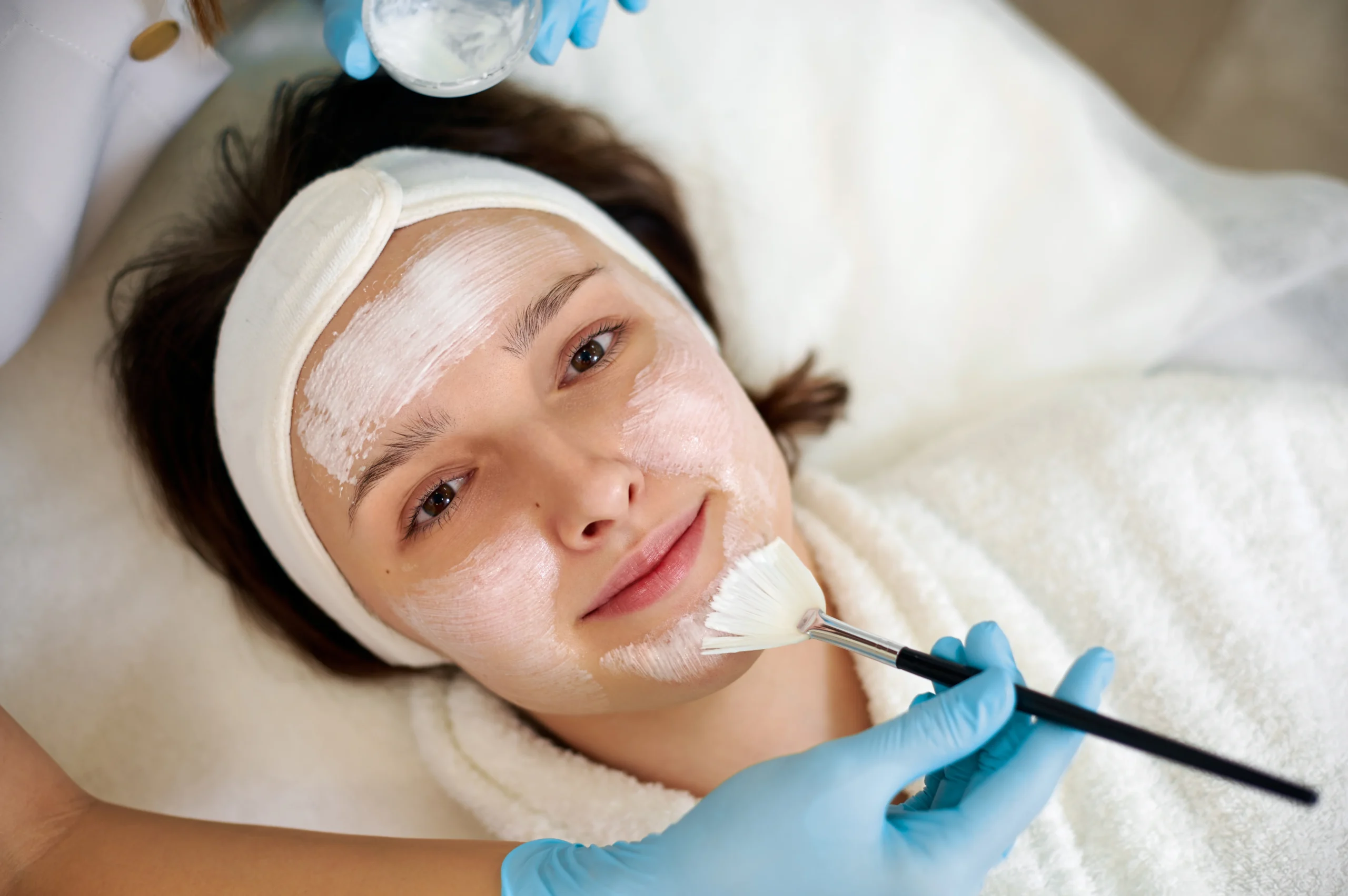 Procedure of Chemical Peels Treatment
