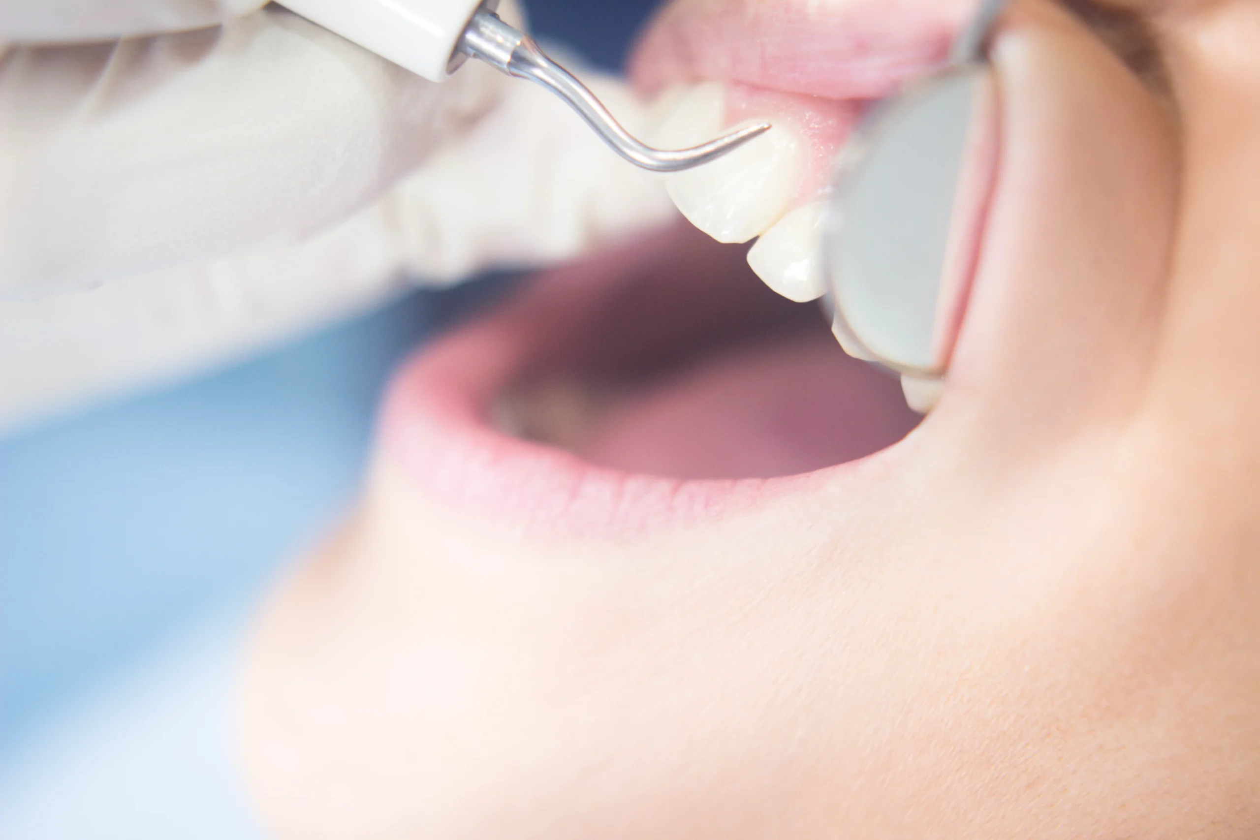 Dental Surgery