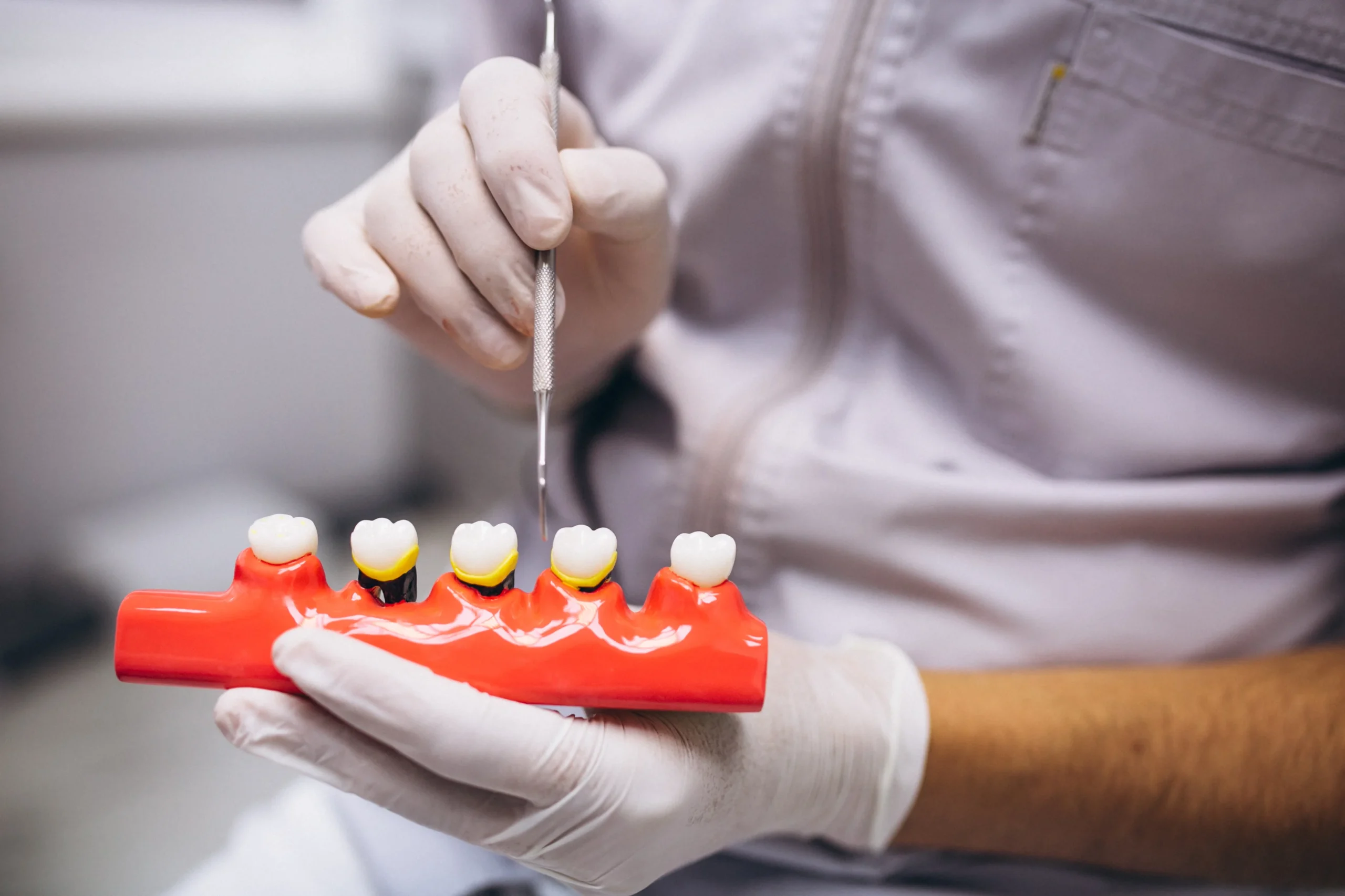 Snap-In Dentures