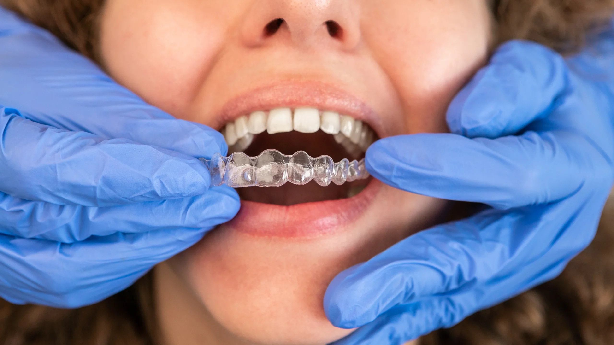 Bruxism