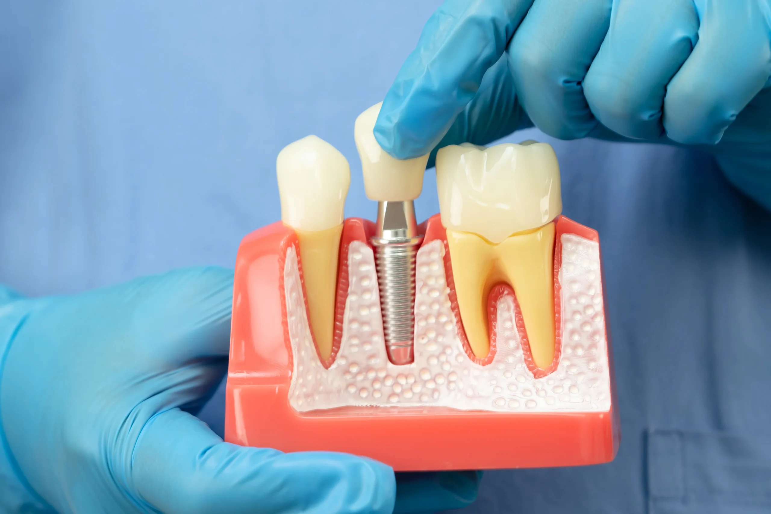 Root Canal and Invisalign Specialists