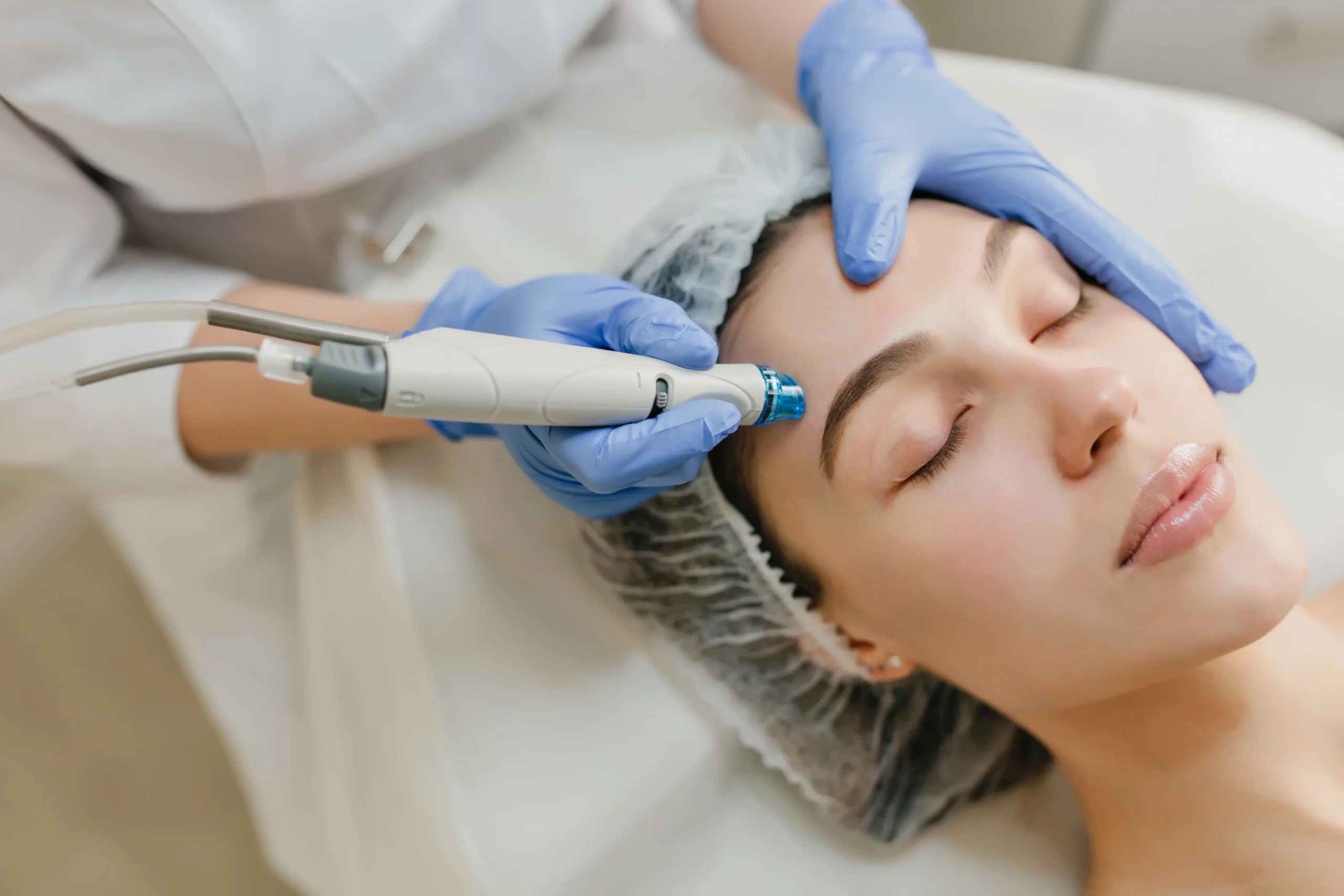 Dermal Resurfacing