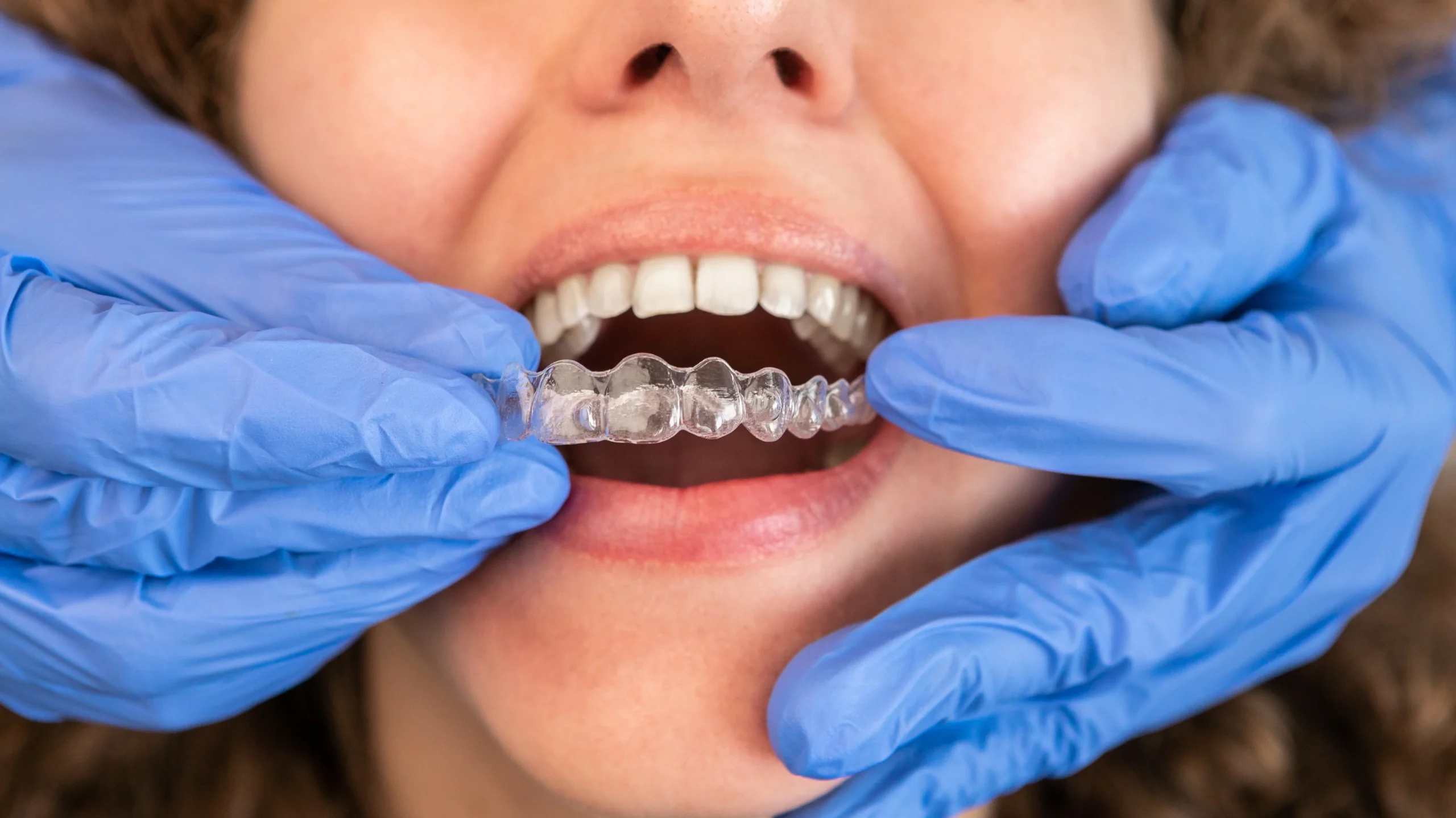 Oral Health