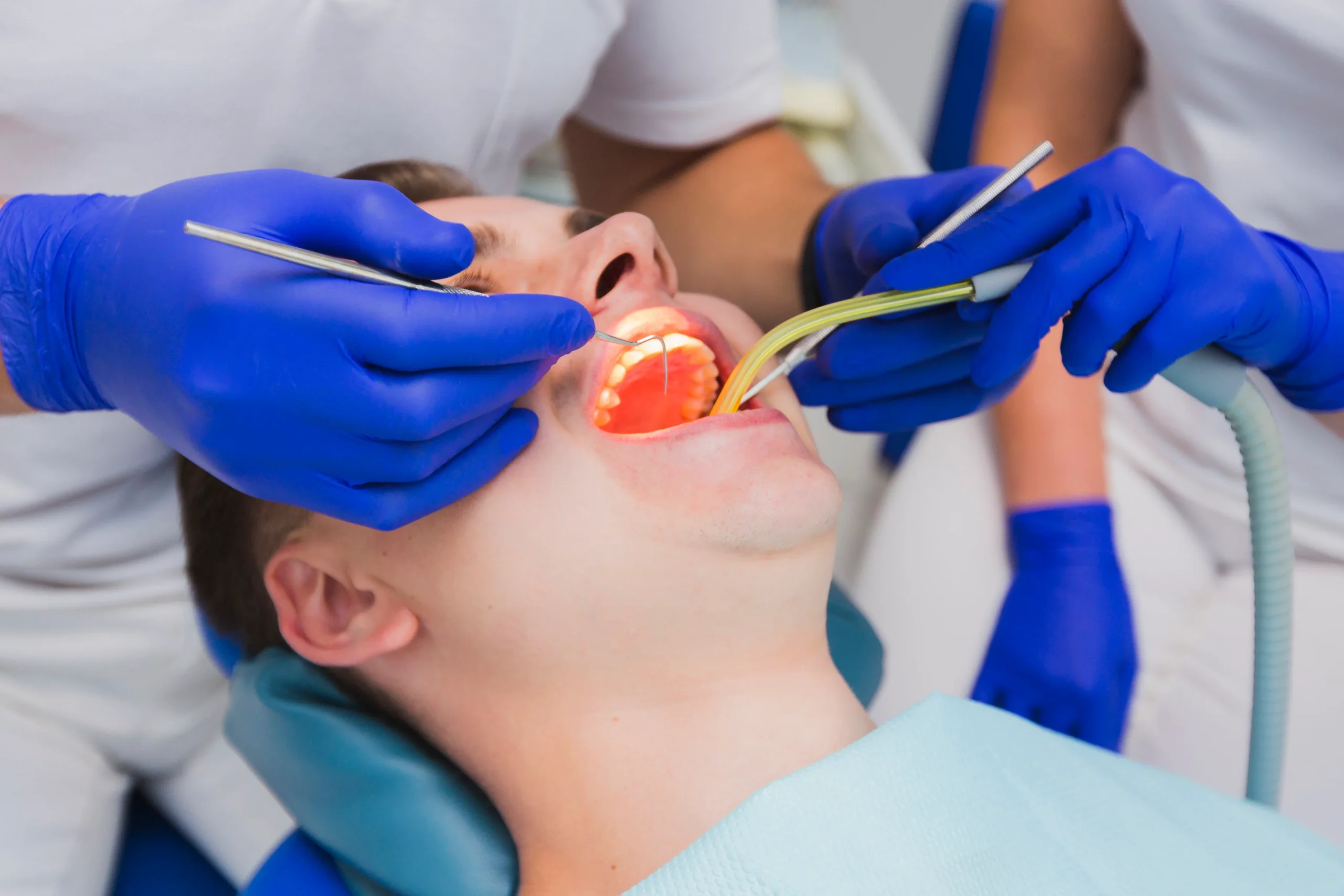 Surgical Extraction