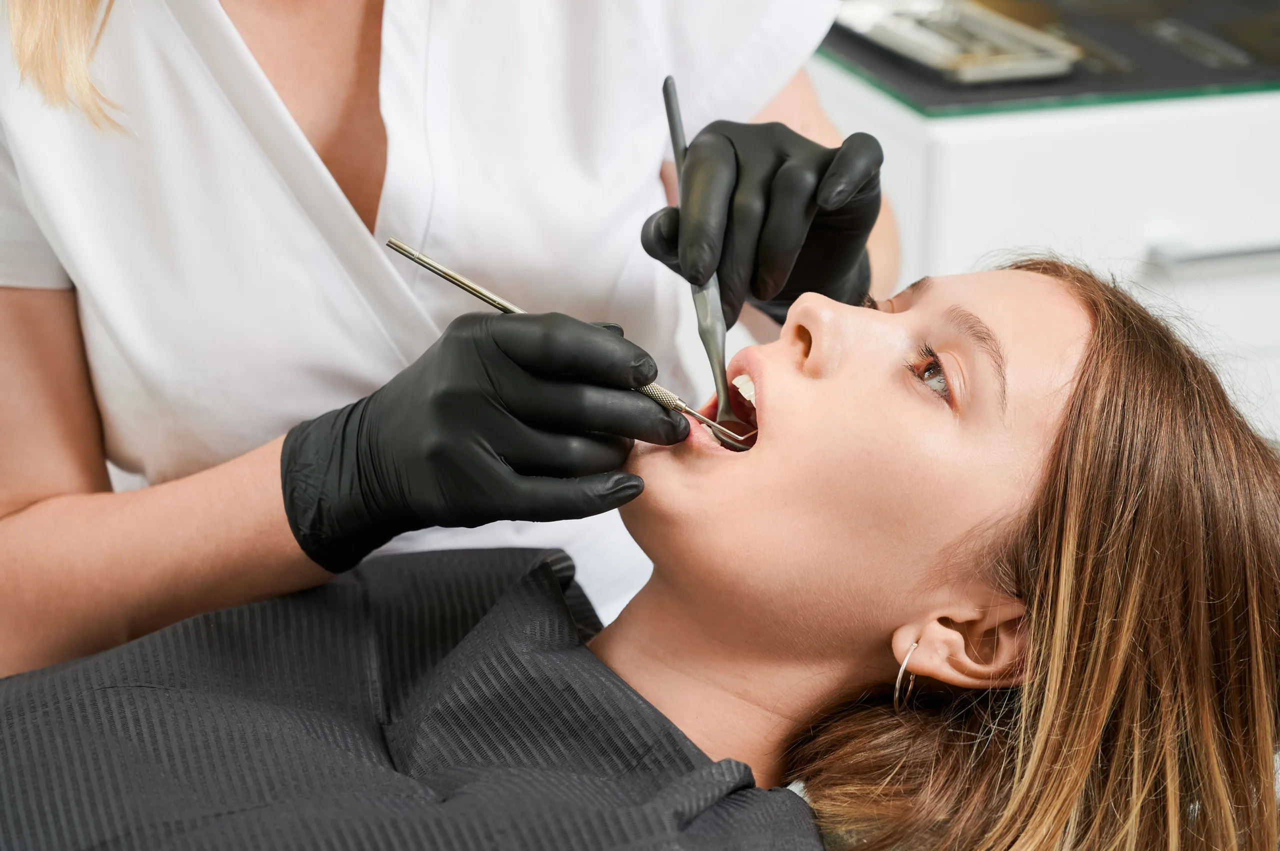 Close-Up of Composite Dental Filling on Molar