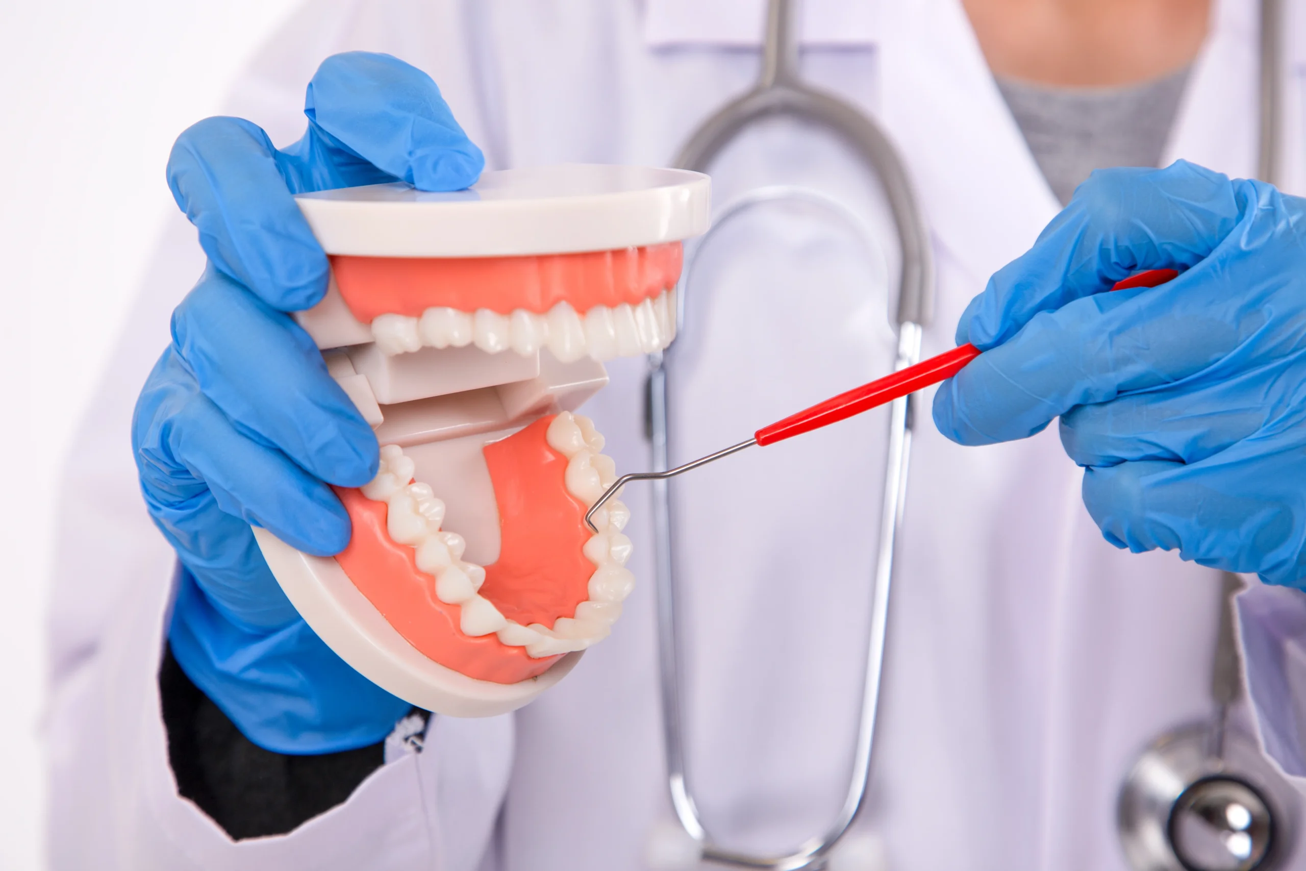 Visual signs of oral cancer