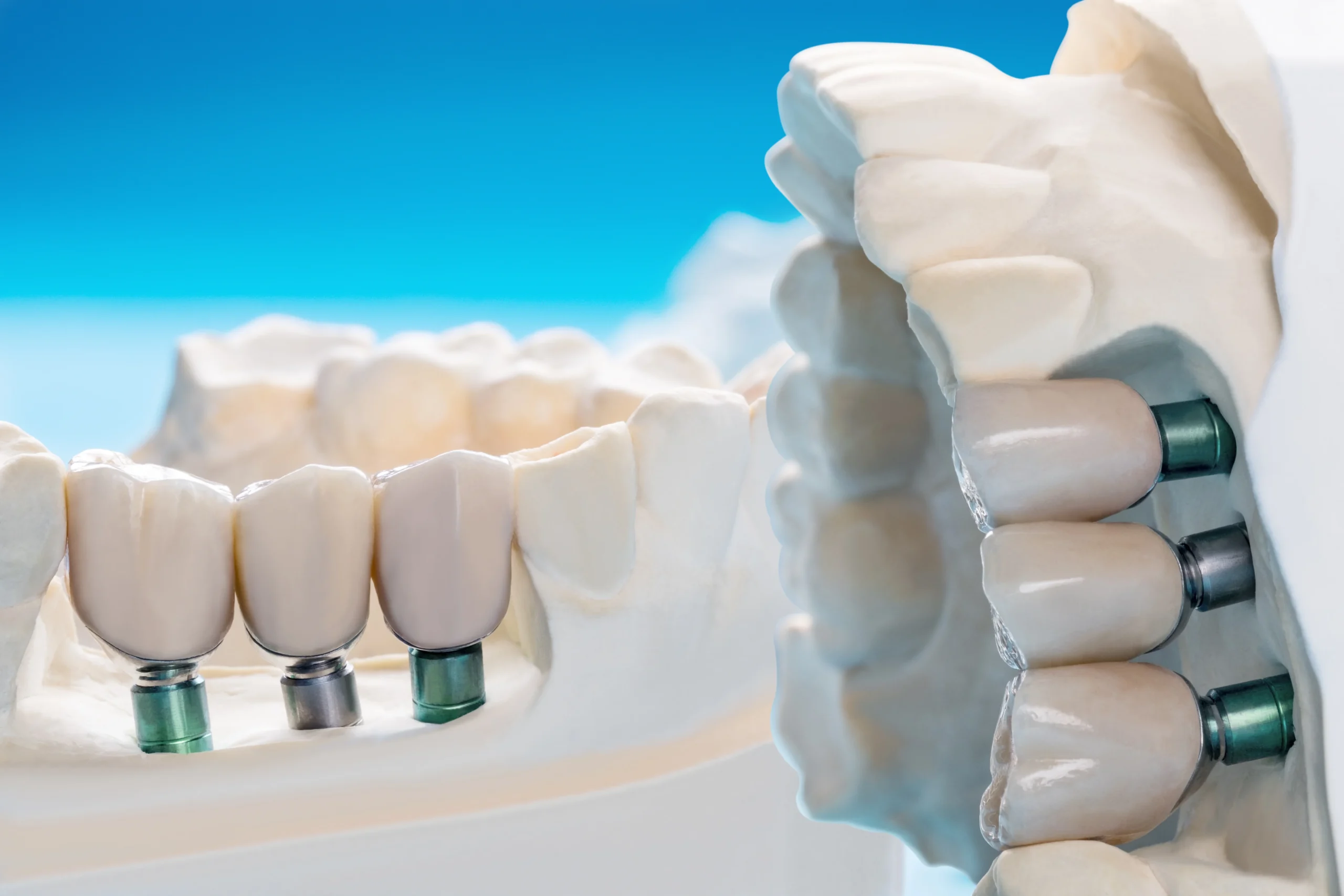 Innovative Dentistree & Aesthetic Clinic in Islamabad