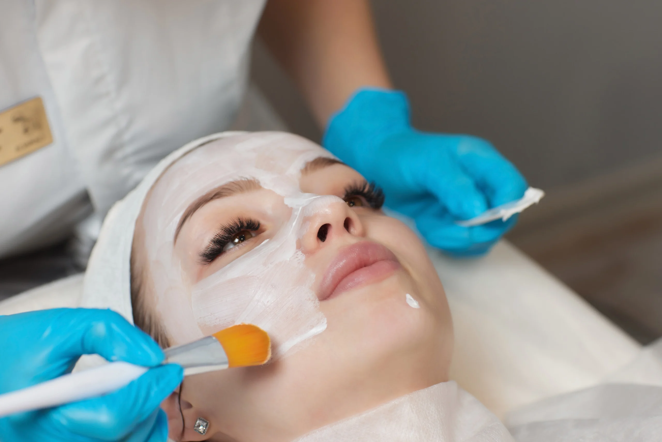 Best skin peels for acne and pigmentation